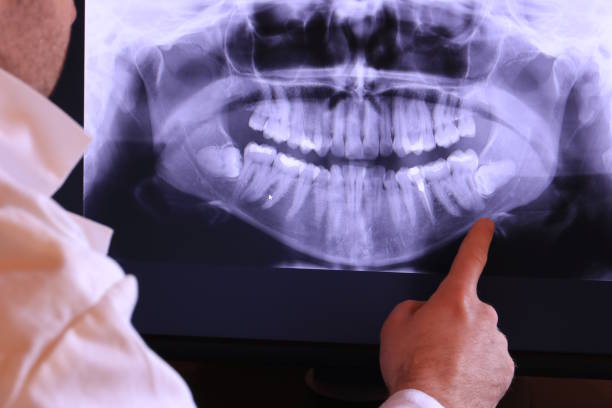 Best Pediatric Emergency Dentist in Finley, WA