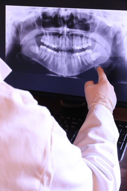 Best Emergency Broken Tooth Repair in Finley, WA