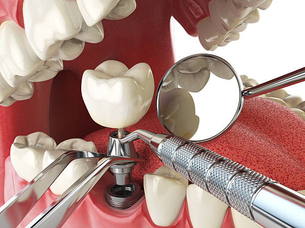 Best Weekend Emergency Dentist in Finley, WA